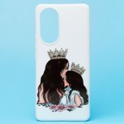 Чехол-накладка SC302 для Huawei Nova 9 (белая) (003) — 1